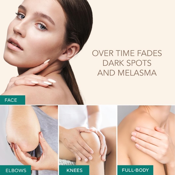 NEW Dark Sun Spot Remover Face Corrector Cream Freckle Skin Damage Aging - Picture 7 of 14